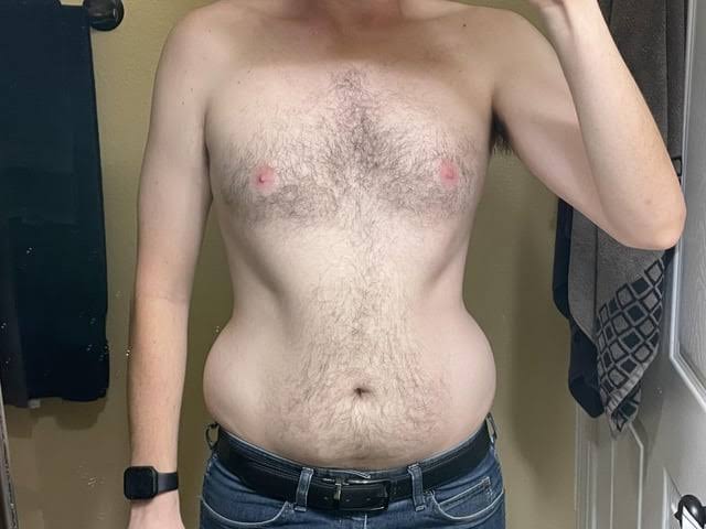 Thread Image