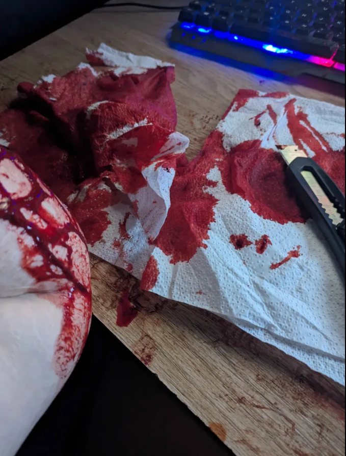 Thread Image